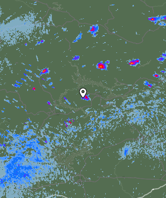 Radar