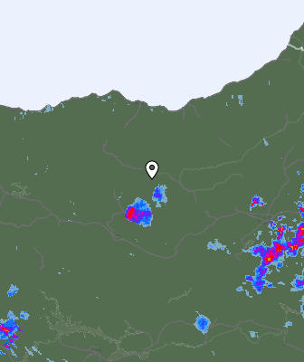 Radar