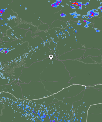 Radar