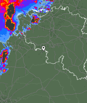 Radar