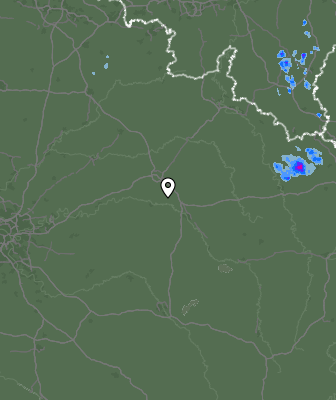 Radar