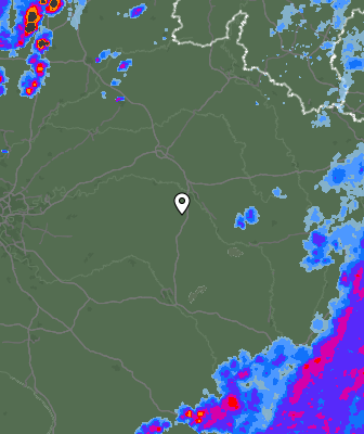 Radar