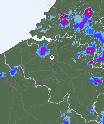 Radar