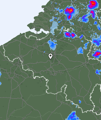 Radar