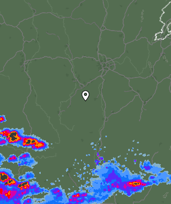 Radar