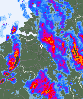 Radar