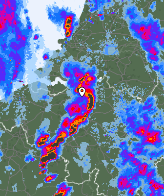 Radar