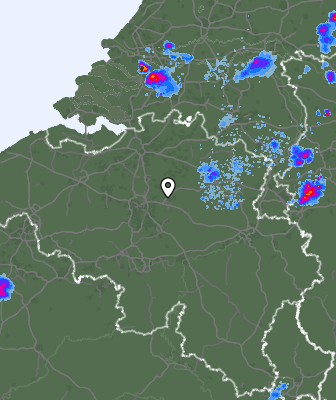 Radar