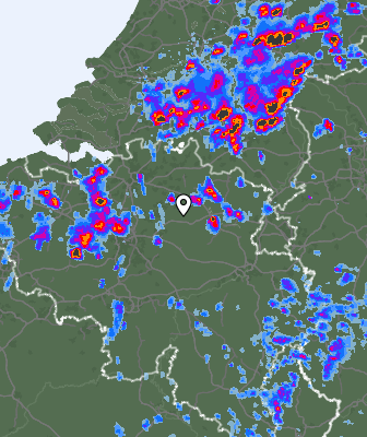 Radar