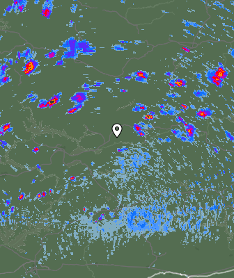 Radar