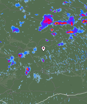 Radar
