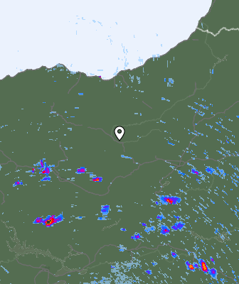 Radar