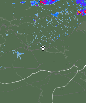Radar