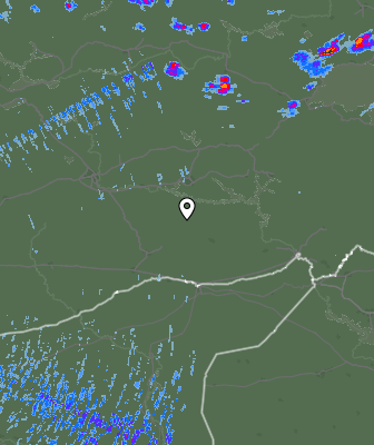 Radar