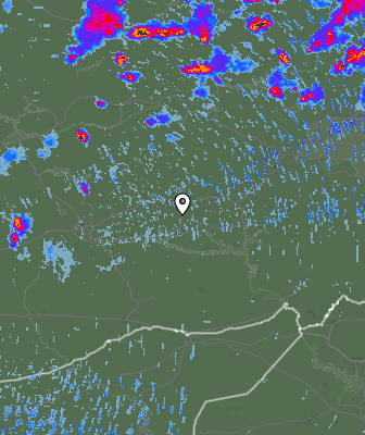 Radar