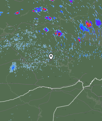 Radar