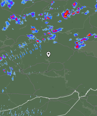 Radar