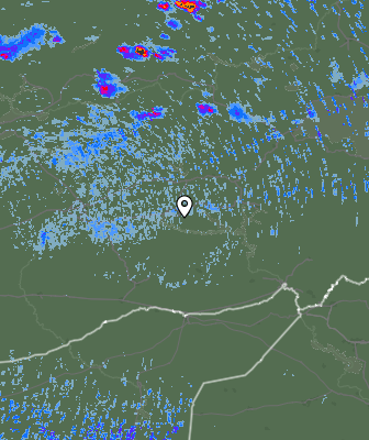 Radar
