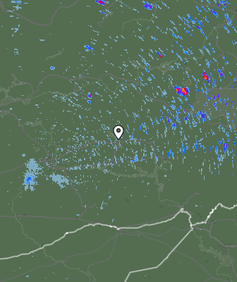 Radar