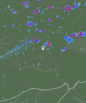 Radar