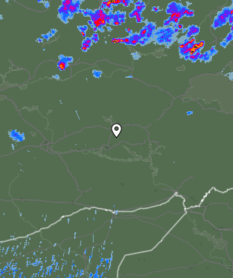Radar