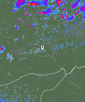 Radar