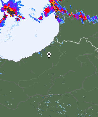 Radar
