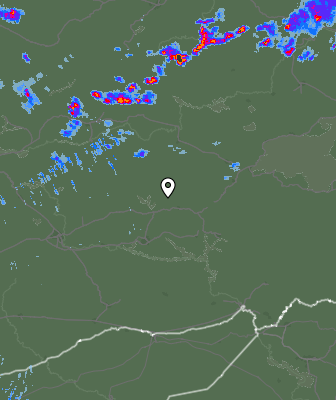 Radar