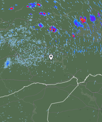 Radar