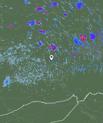 Radar