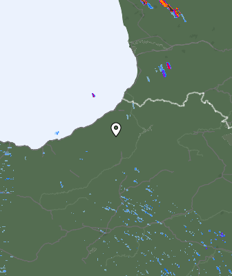 Radar