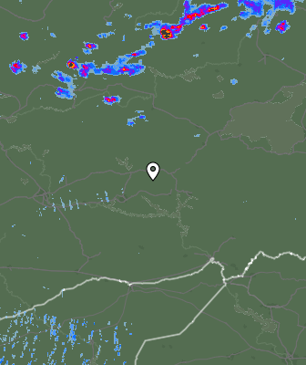 Radar