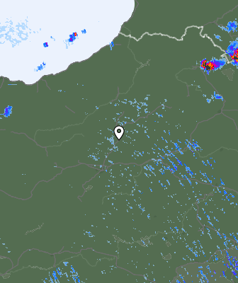 Radar