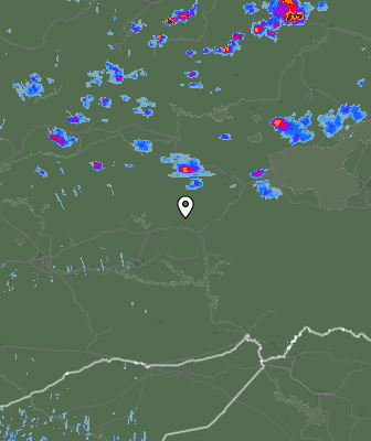 Radar