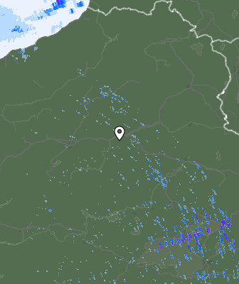 Radar