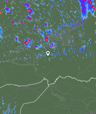 Radar