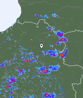 Radar