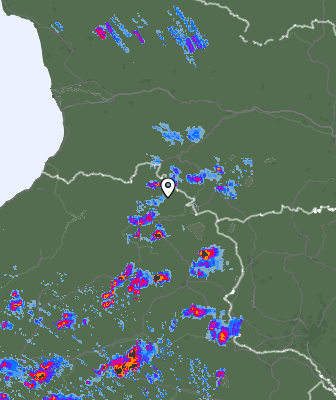 Radar