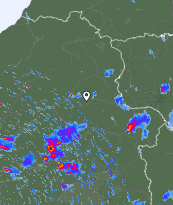 Radar