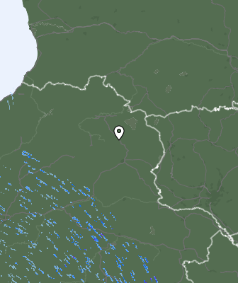 Radar
