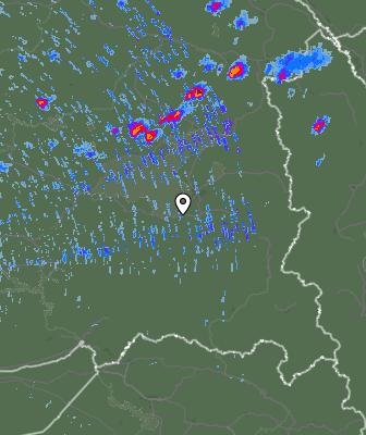 Radar