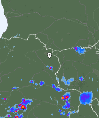 Radar