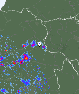 Radar