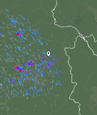 Radar