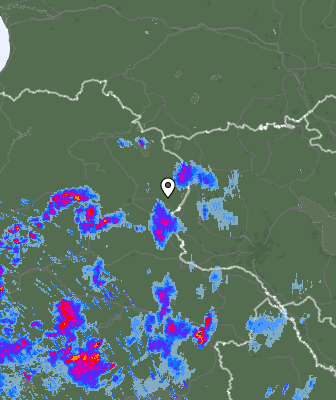 Radar
