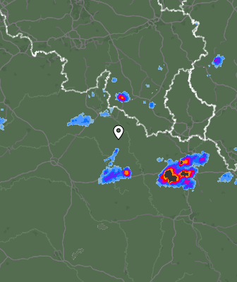 Radar