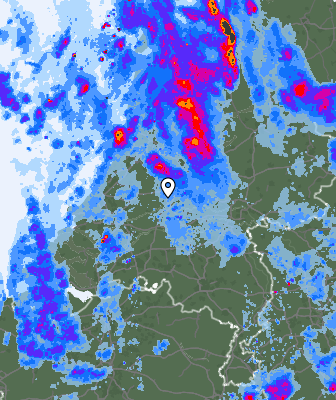 Radar