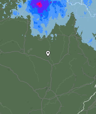 Radar