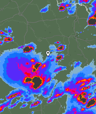 Radar
