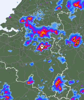 Radar